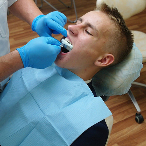 Снятие слепков